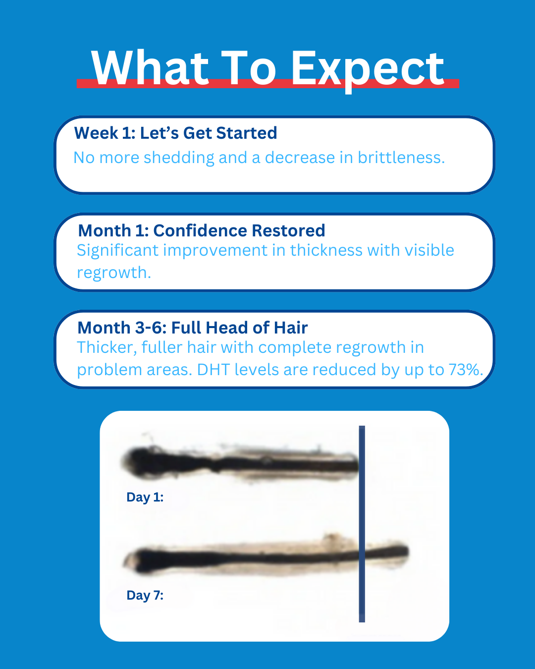 Strands Up - QuadStim™ Roller For Hair Loss