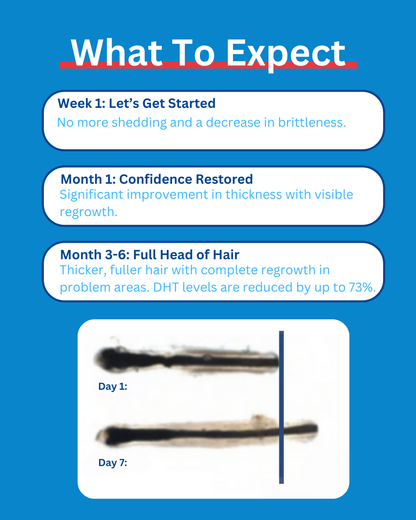 Strands Up - QuadStim™ Roller For Hair Loss