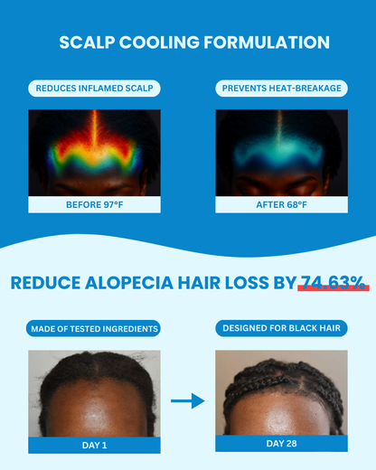 Strands Up - QuadStim™ Roller For Hair Loss