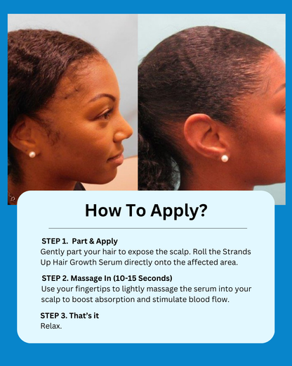 Strands Up - QuadStim™ Roller For Hair Loss